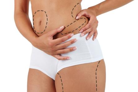 Как восстановиться после родов? Часть первая: идеальное тело