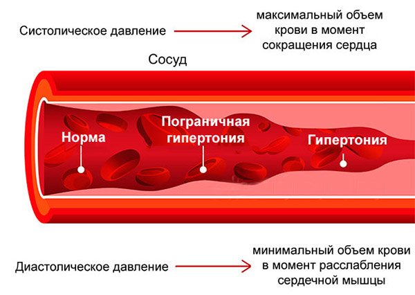 Напряжение сосудистой стенки у кошек